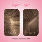 Anti Dendruff Conditioner